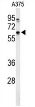 Anti-DCT / TRP2
