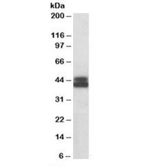 Anti-HLA-B