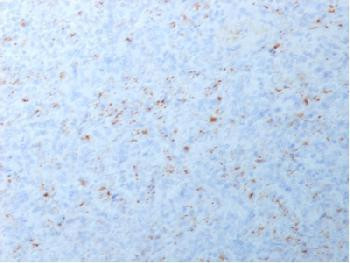 Anti-MMP3 Recombinant Rabbit Monoclonal Antibody (clone:MMP3/1994R)