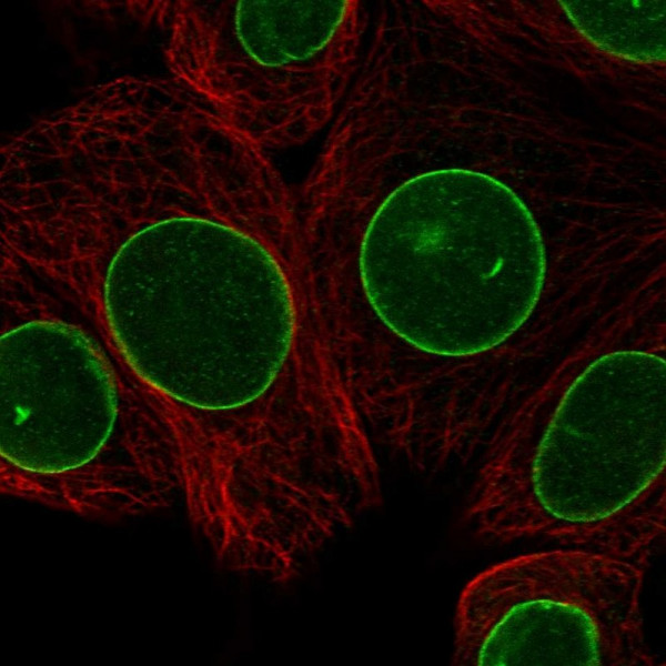 Anti-TOR1AIP1