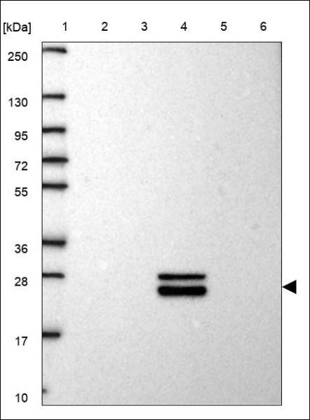 Anti-SPP2
