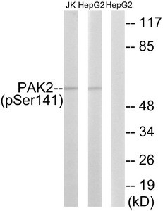 Anti-Phospho-PAK2 (Ser141)
