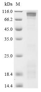 cGMP-specific 3&#039;,5&#039;-cyclic phosphodiesterase (PDE5A), partial, human, recombinant