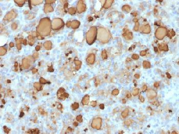 Anti-Thyroglobulin (Thyroidal Cell Marker) Recombinant Mouse Monoclonal Antibody (clone:rTGB24)