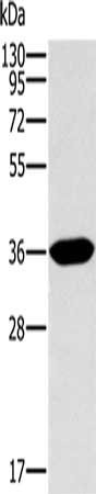 Anti-ITLN1