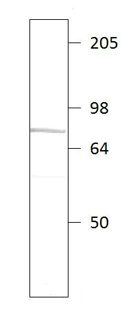 Anti-PDE9A