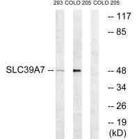 Anti-SLC39A7
