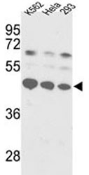 Anti-SSB / Lupus La protein