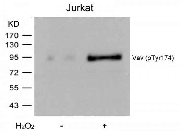 Anti-phospho-Vav (Tyr174)