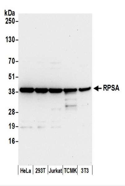 Anti-RPSA