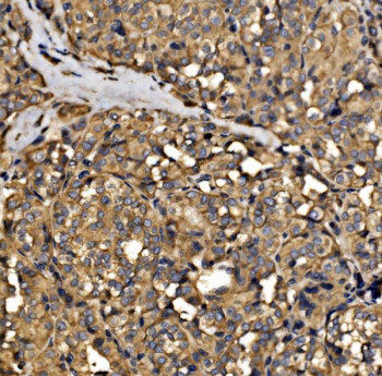 Anti-SRP72 / Signal recognition particle 72 kDa protein