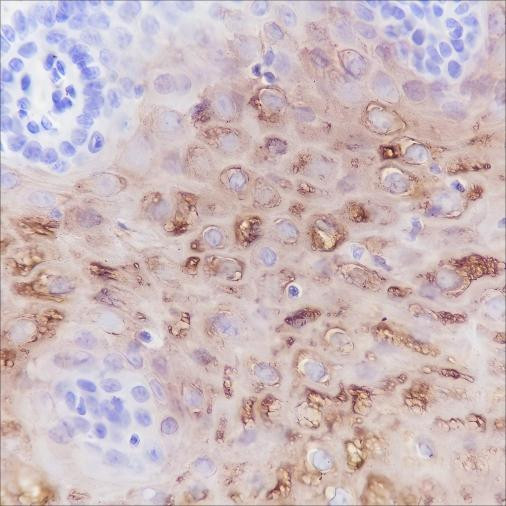 Anti-Recombinant Keratin 4, clone A279