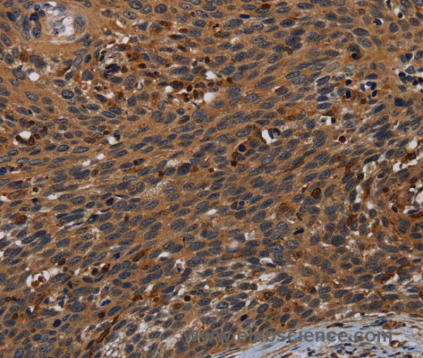 Anti-PCDHB15
