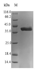 Astrocytic phosphoprotein PEA-15 (PEA15), human, recombinant