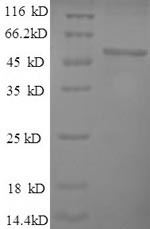 Alpha-enolase (Eno1), partial, mouse, recombinant