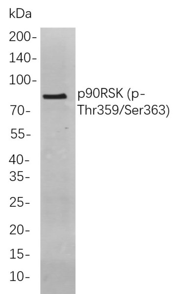 Anti-Recombinant Phospho-p90RSK(Thr359, Ser363), clone 9B8