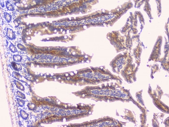 Anti-PYY / Peptide YY