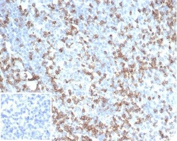 Anti-CD2 / Lymphocyte Function Antigen 2 (LFA-2), clone LFA2/7104