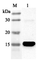 Anti-FABP4 (human)