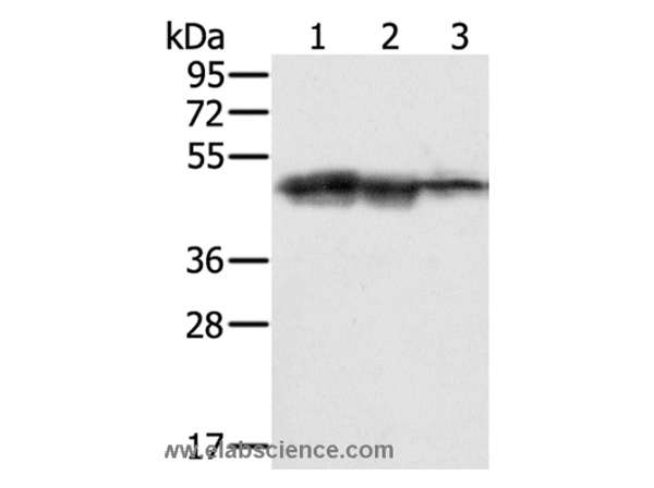 Anti-SMARCB1