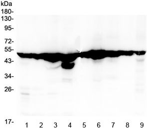Anti-FH / Fumarate hydratase