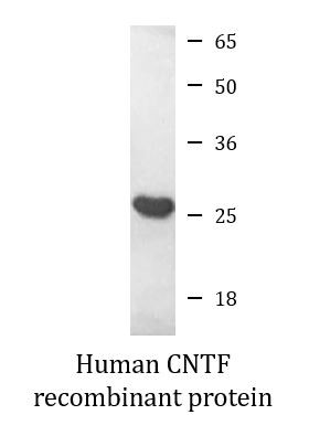 Human CNTF recombinant protein (Active)