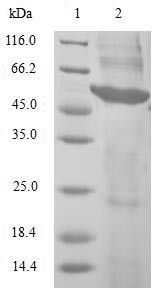 5'-AMP-activated protein kinase subunit beta-2 (PRKAB2), human, recombinant