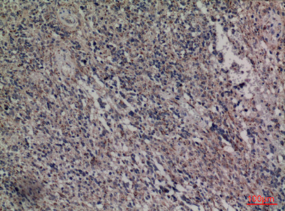 Anti-HDC / Histidine decarboxylase