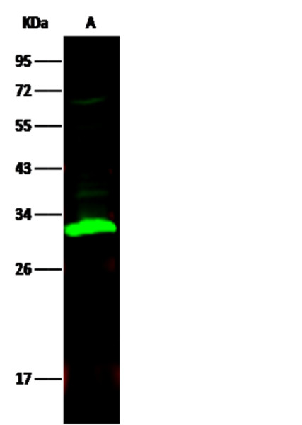 Anti-Carbonic Anhydrase II/CA2 Monoclonal Recombinant Antibody