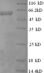 Eukaryotic translation initiation factor 4 gamma 1 (EIF4G1), partial, human, recombinant