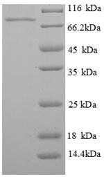 Phosphoenolpyruvate carboxykinase, cytosolic [GTP] (PCK1), human, recombinant