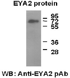Anti-EYA2