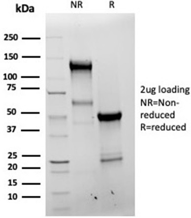 Anti-Bcl-X (Apoptosis Marker), recombinant antibody, clone BCL2L1/4509R