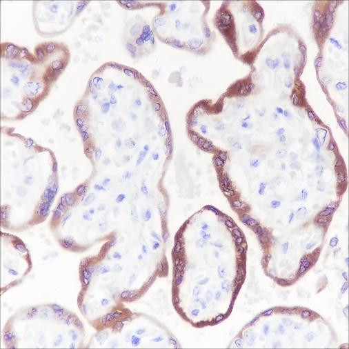 Anti-Recombinant hCG beta, clone A243