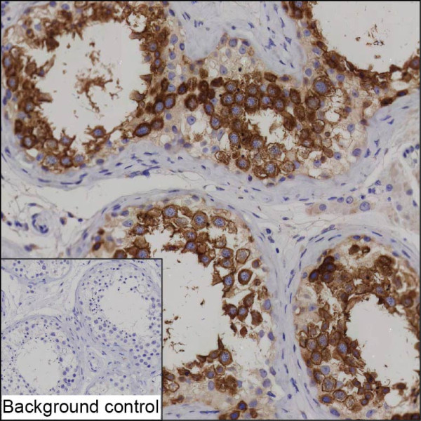 Anti-DPEP3 (recombinant antibody)