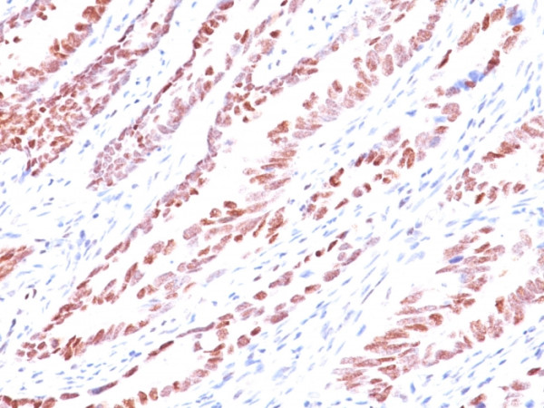 Anti-p57Kip2 (Mitotic Inhibitor/Suppressor Protein), clone KP10