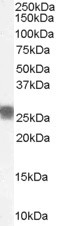 Anti-SSP29 / ANP32B, C-terminal