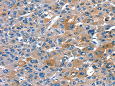 Anti-RNF7