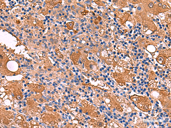 Anti-FUCA2