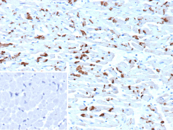 Anti-N-Cadherin / Cadherin-2 / CD325 (NCAD), clone CDH2/9492