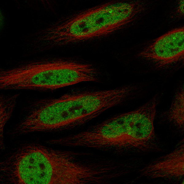 Anti-ABCB5, clone CL13779