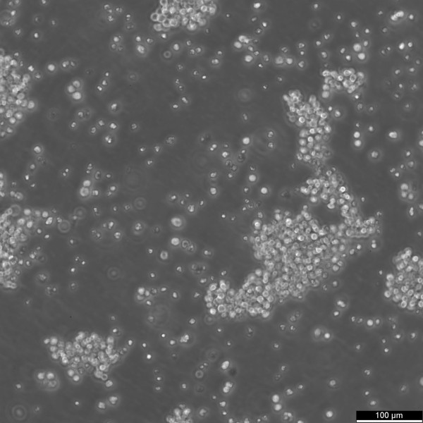 BJAB Cells