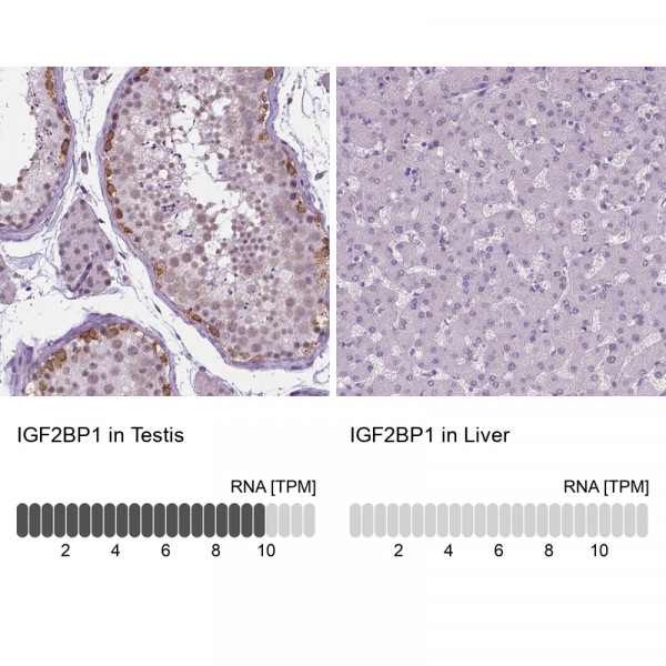 Anti-IGF2BP1