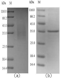 Legumain (Lgmn), mouse, recombinant