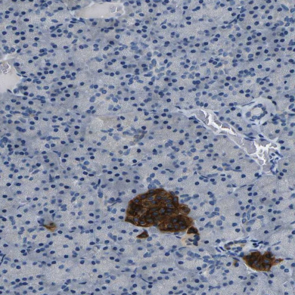 Anti-FAM159B