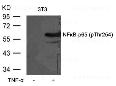 Anti-phospho-NFkB-p65 (Thr254)