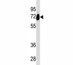 Anti-Alkaline Phosphatase, clone 421CT8.1.1