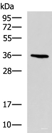Anti-BDNF
