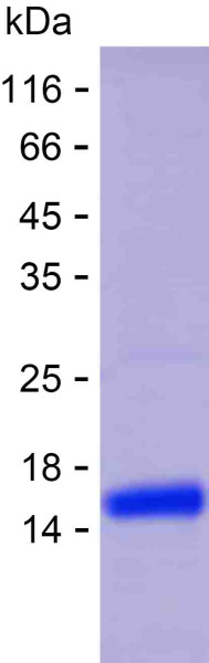 Recombinant Human ZNF736 Protein