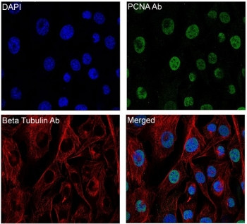 Anti-Beta Tubulin / TUBB, clone BI-20